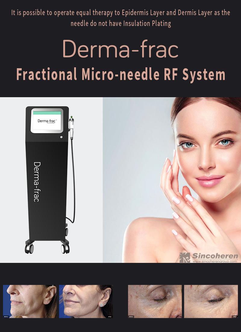 New Arrival Vertical Type Microneedle RF Skin Rejuvenation Beauty Microneedle RF Machine