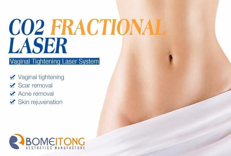 FDA Medical Equipmentrf CO2 Laser Vaginal Rejuvenation Skin Tigthening