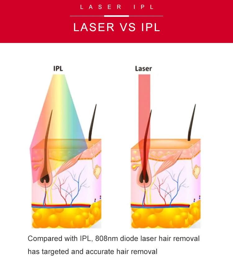 Top Quality Beauty Equipment Professional Laser Machine 808nm Diode Laser Hair Removal Machine