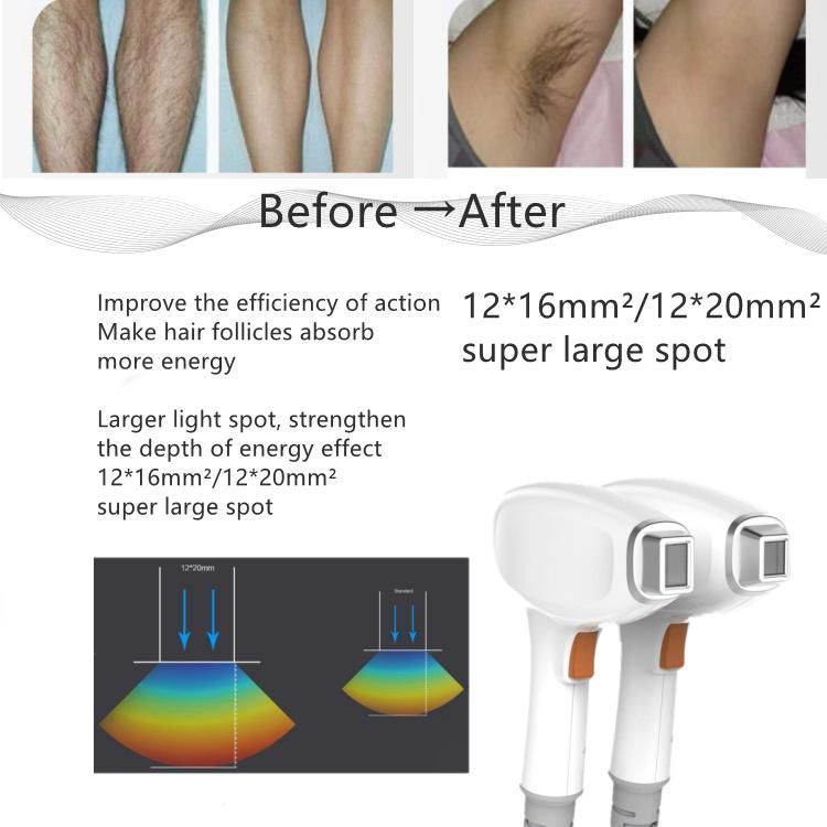 Professional Hair Removal Diode Portable 3 Wavelength 755 1064 808cm Diode Hair Removal Machine