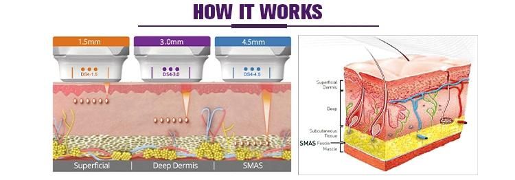 11 Lines 6 Cartridges Anti Wrinkle Face Lift Skin Tightening Body Slimming Hifu 3D 4D Hifu Beauty Machine