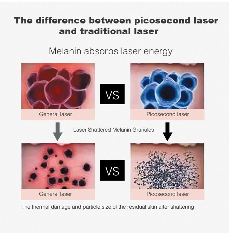 Best Quality Portable Picosur Picosecond Laser for All Pigment Removal and Tattoo