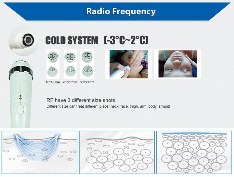 3 in 1 E-Light +RF+Laser Multifunction Beauty Machine