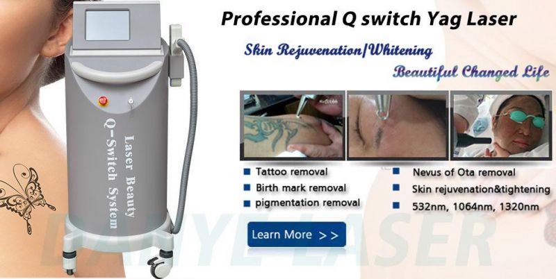 Professional 1064 532 Nm Q Switch ND YAG Eyebrow and Pigmentation Laser Tattoo Removal