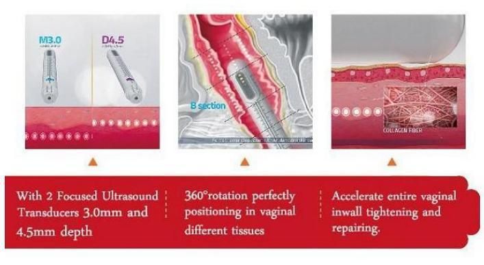 Wrinkle Removal Face Lifting Fat Ruduction Three in One Hifu Machine