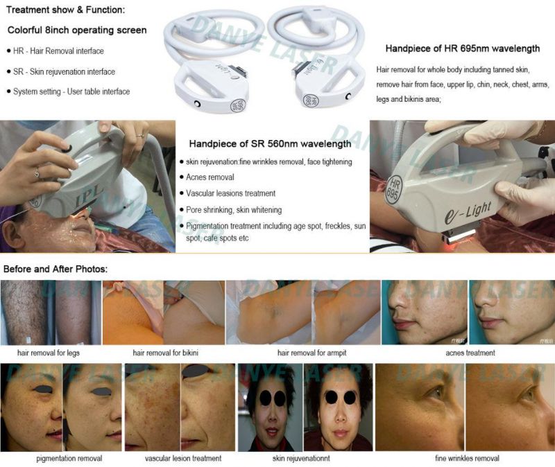 Skin Care Opt Painless Permanent Hair Removal Laser IPL Multifunction Facial Beauty Machine