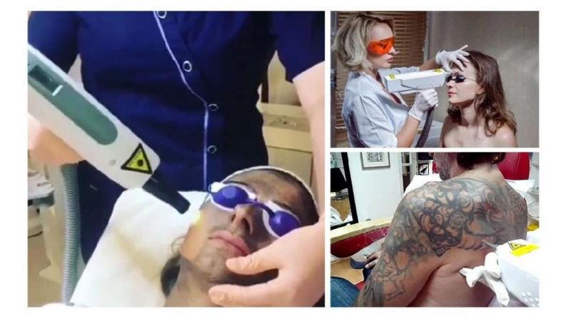 Tattoo Removal Skin Rejuvenation Mini ND YAG Laser Machine