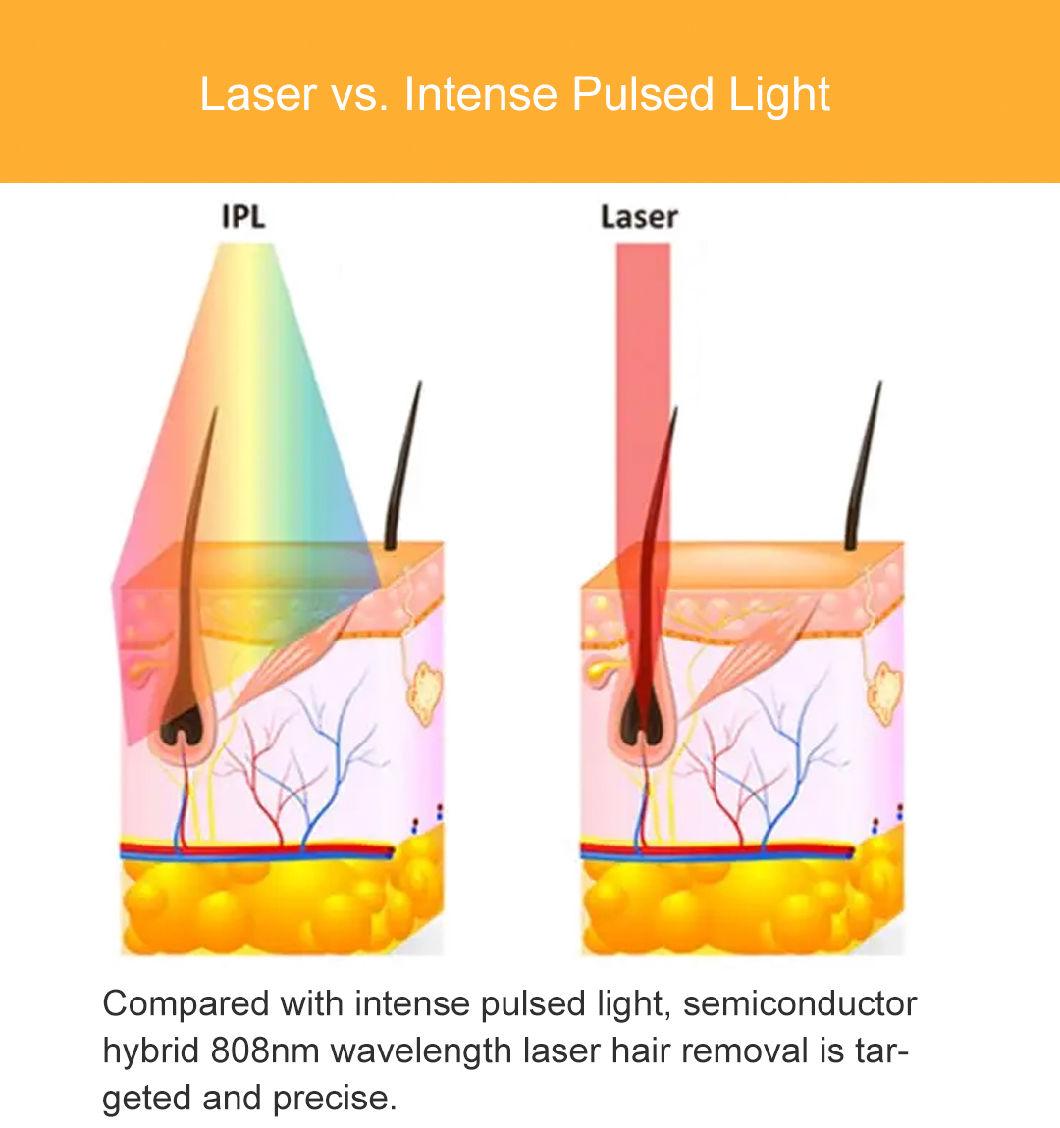 Portable Diode Laser Hair Removal /808nm Laser Epilator 808nm Diode Laser Machine Portable 808nm Diode Laser