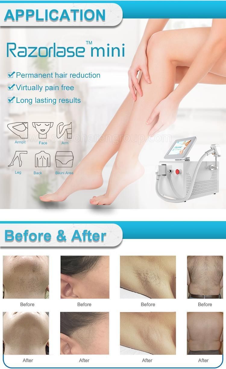 Free Shipping Professional 755 808 1064 Machine Portable Beauty Equipment New Painless Device Permanent Diode Laser Hair Removal