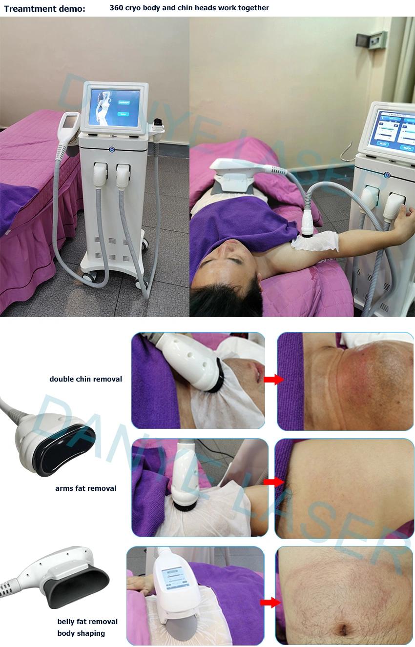 Non-Invasive and Safe Vacuum Fat Freezing Body Contour Culpting 360 Cryolipolysis in 2020