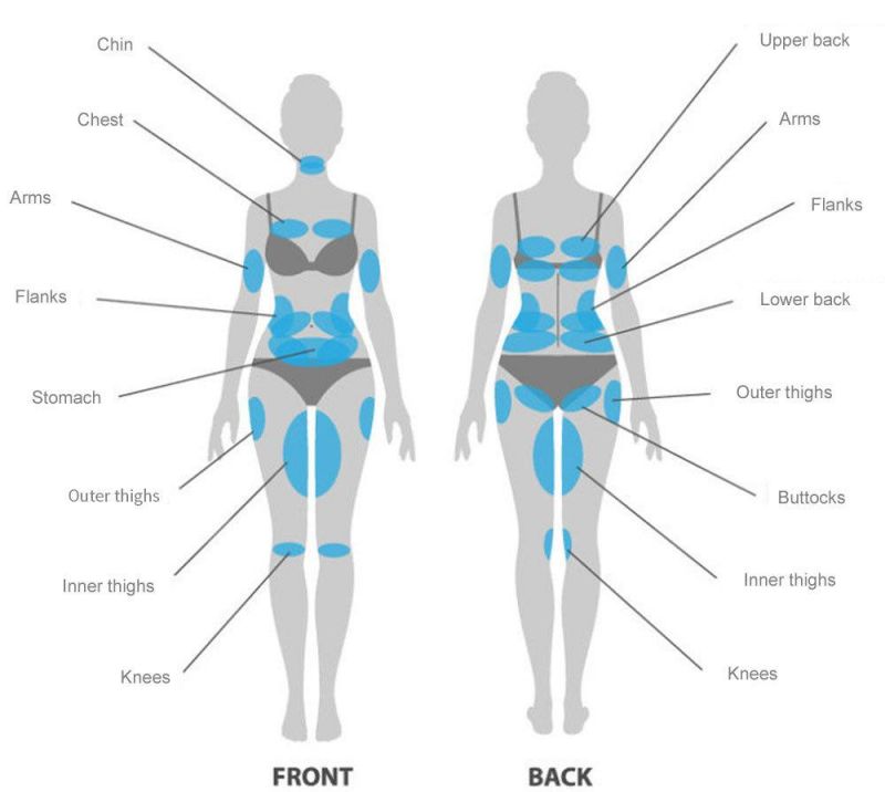 Germany Fat Freeze Most Effective Sincoheren Coolplas CE Approved Cryotherapy Cryo Fat Freezing Machine