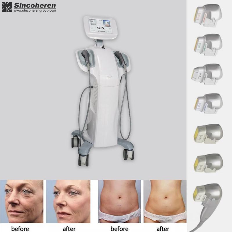 7D Hifu 7D Hifu Wrinkle Removal Delay Aging Hifu Improve Skin Water Capacity 2 Handles 7D Hifu Device