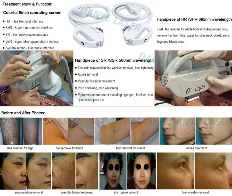 CE Approved Skin Therapy IPL Hair Removal Machine Acne Treatment Skin Rejuvenation Pore Shrinking