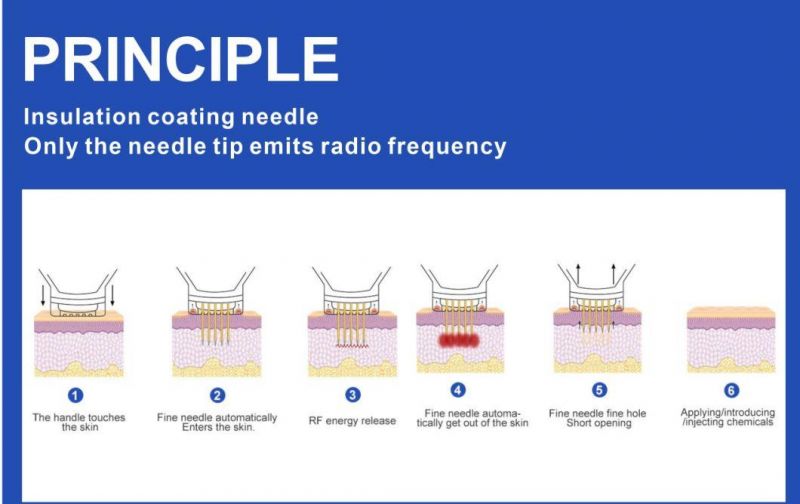 Needling RF Cartridge System Wrinkle Removal Portable Intracel Microneedling Fractional Machine