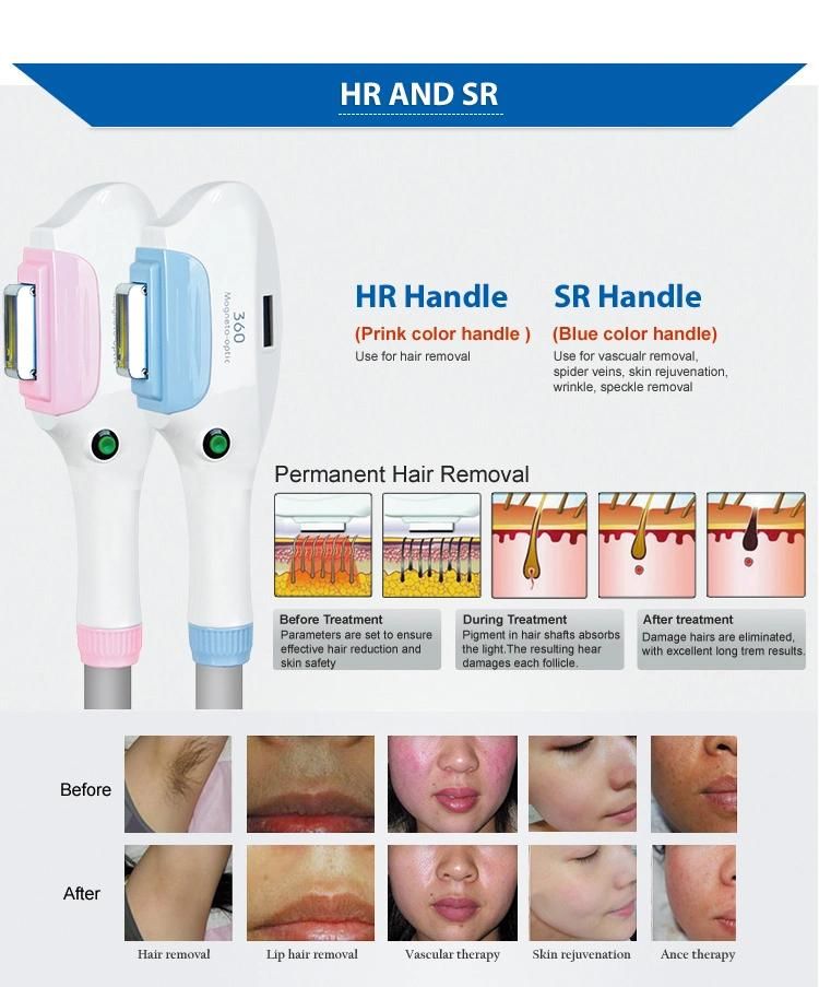 Magneto-Optical IPL Hair Removal / Laser Tattoo Removal / RF Skin Tightening 4 in 1 Machine