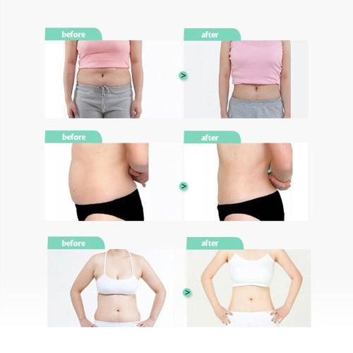 Cryolipolysis Weight Slimming Fat Reduction Salon Equipment Loss Weight
