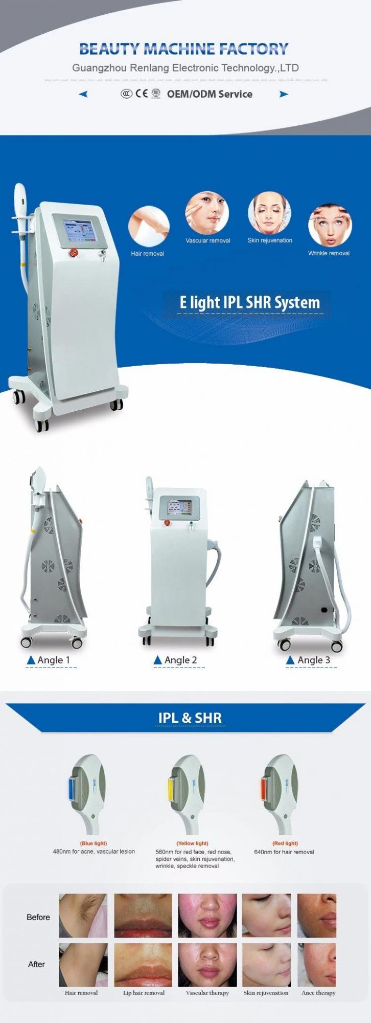 Painless Laser Hair Removal IPL Machine with Medical Ce Certification