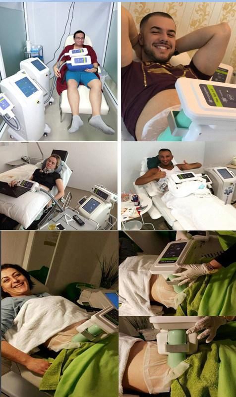 CE Approved Fat Freezing Machine