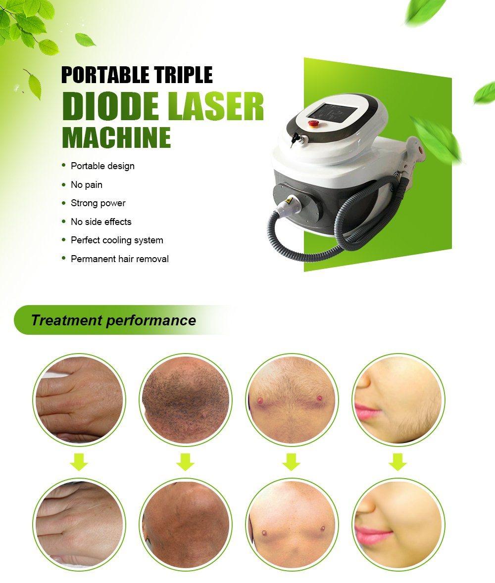 Portable Permanent Hair Removal Laser 3 Wavelength Diode Laser Machine