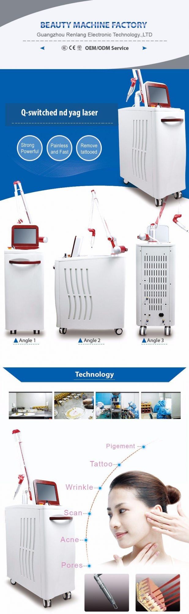 2000mj Q Switched for Pigment Removal with Ce Certification