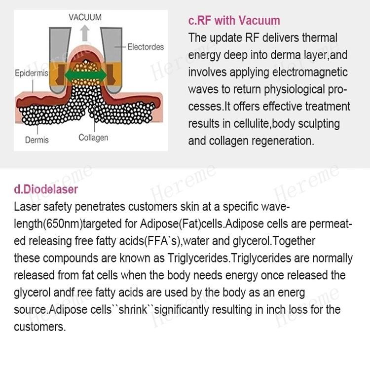 Multi Functional Five-in-One Ultrasonic Slimming and Fat Reducing Instrument