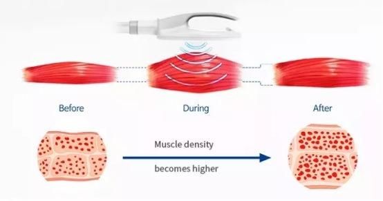 Portable Non-Invasive High Intensity Electromagnetic Muscle Trainer Machine