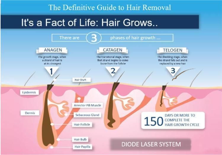 Diode Laser Machine Hair Removal Device