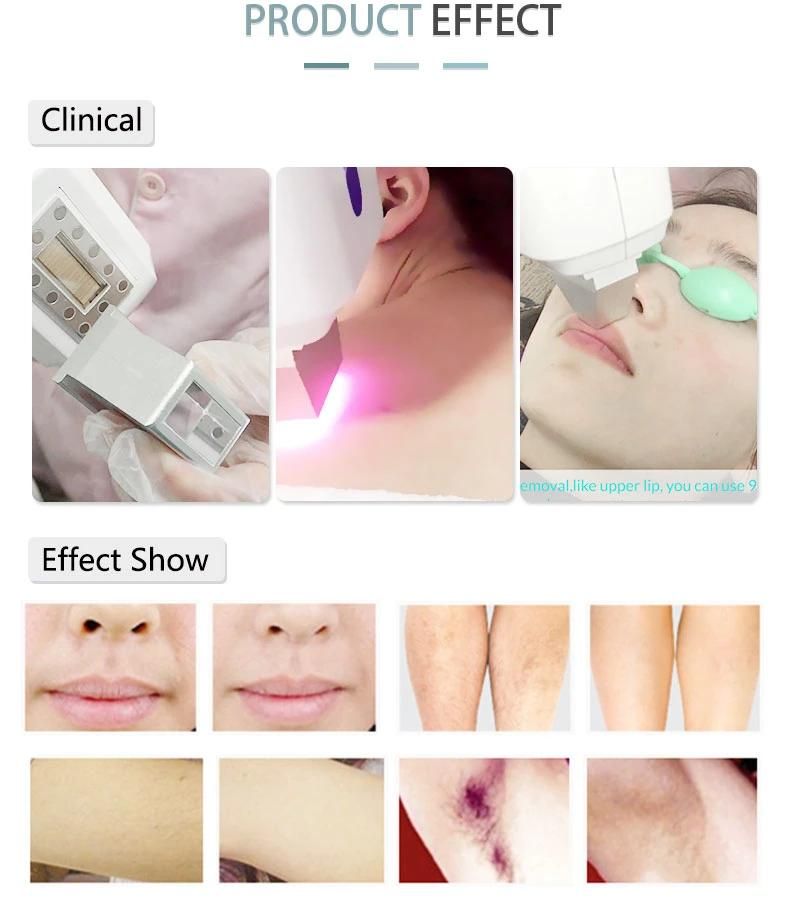 12 Hours Non-Stop Continue Working Epicare Hair Removal Diode Laser