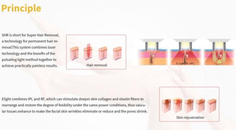 IPL Laser Hair Removal Skin Rejuvenation E-Light IPL RF Epilation Machine China Manufacturer