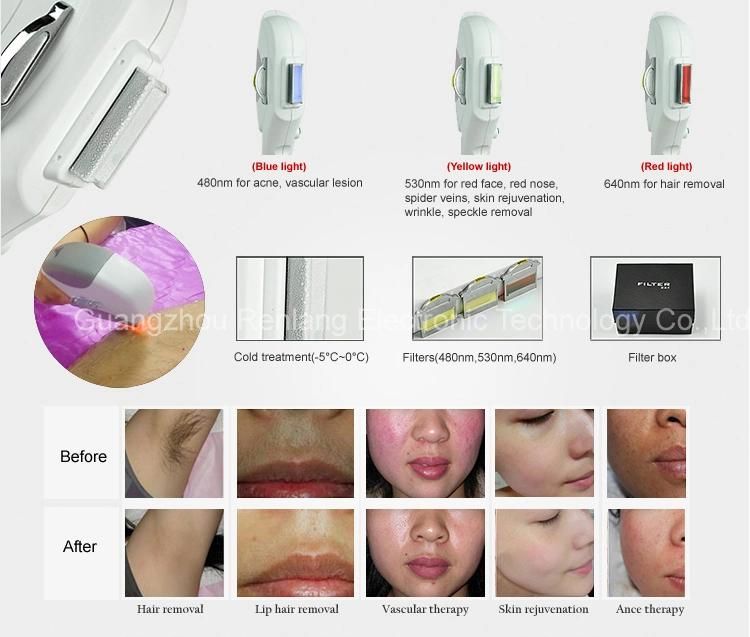 IPL / RF / Laser Multi Beauty System Machine for Hair Removal / Skin Tightening / Tattoo Removal