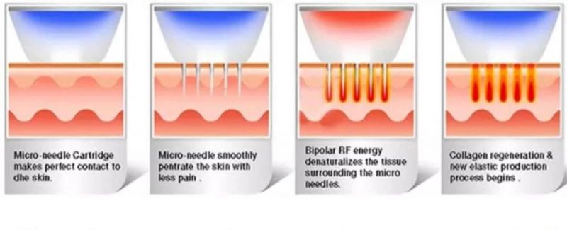 Skin Care, Wrinkles Removal RF Microneedles