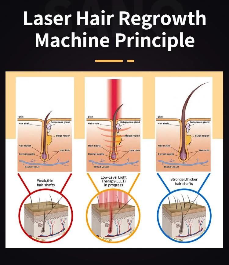 Laser Hair Growth Laser Therapy Machine for Hair Loss Treatment