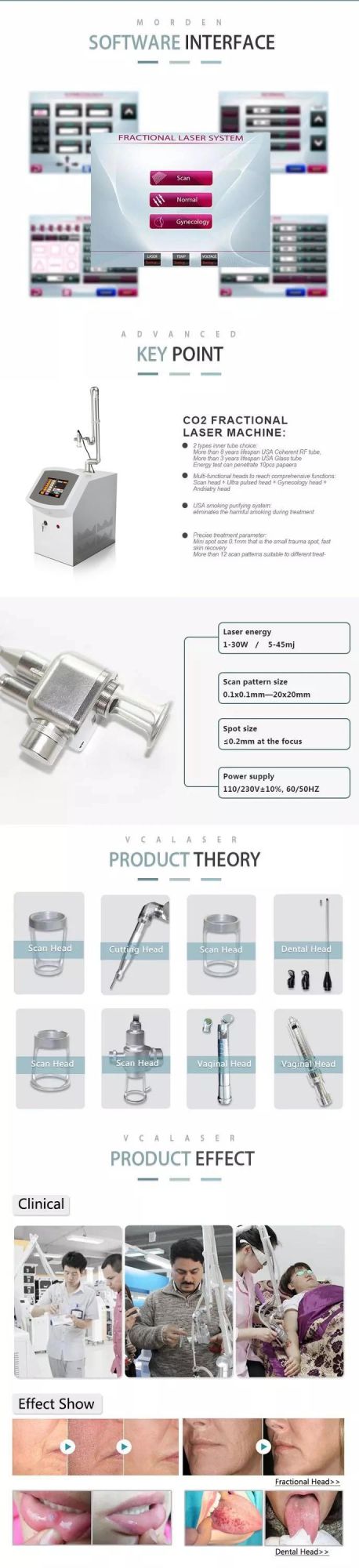 Fashion CO2 Fractional Laser for Scar Removal Skin Resurface Equipment