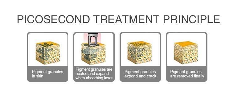 Picosecond Pigmentation Removal Laser Q-Switched Laser Machine ND YAG Tattoo Removal Laser