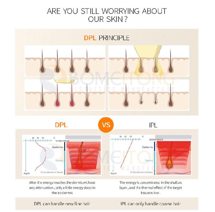 Dpl Machine Skin Rejuvenation and Dpl Elight Shr