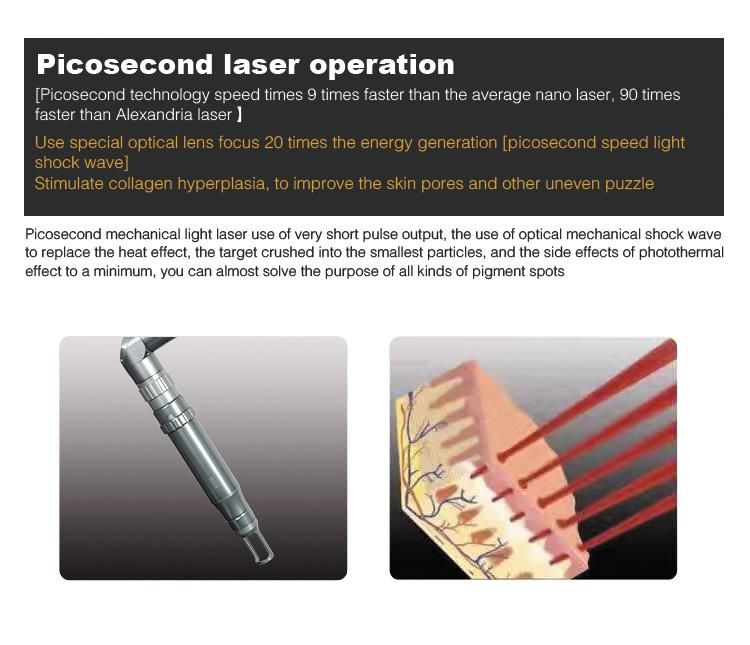 Korean Arm Picosecond Laser Effective Tattoo Removal Machine for Sale