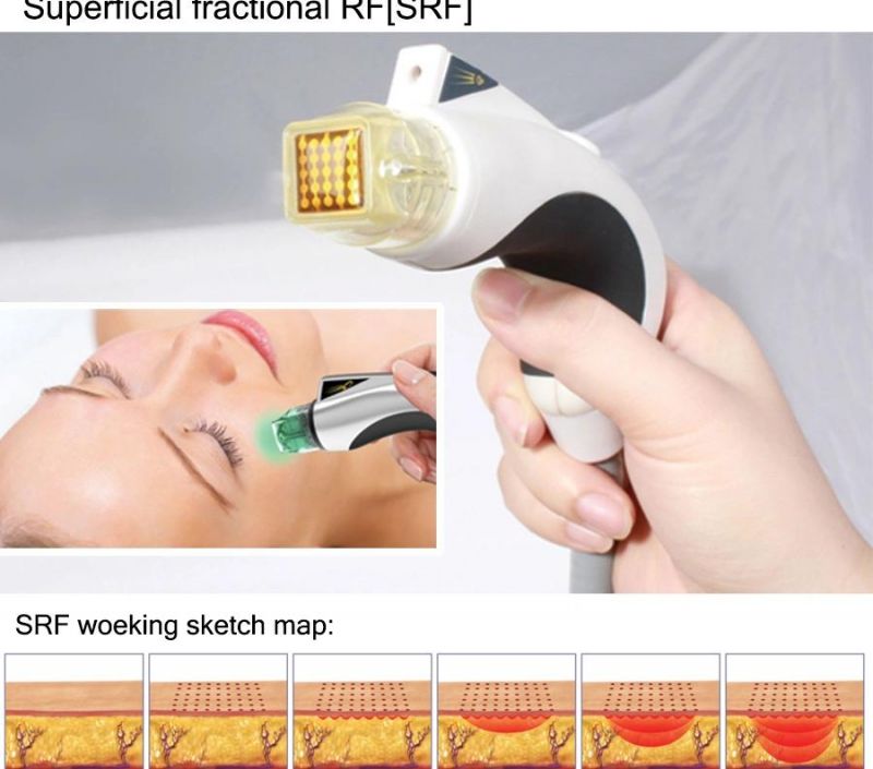 2015 High Quality Srf+PDT Skin Rejuvenation Microneedle RF Beauty Machine (MR20-1SP)