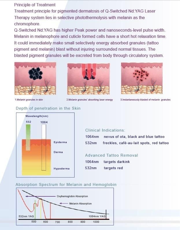 Q-Switch ND YAG Laser Tattoo Removal Laser Skin Care Medical Equipment