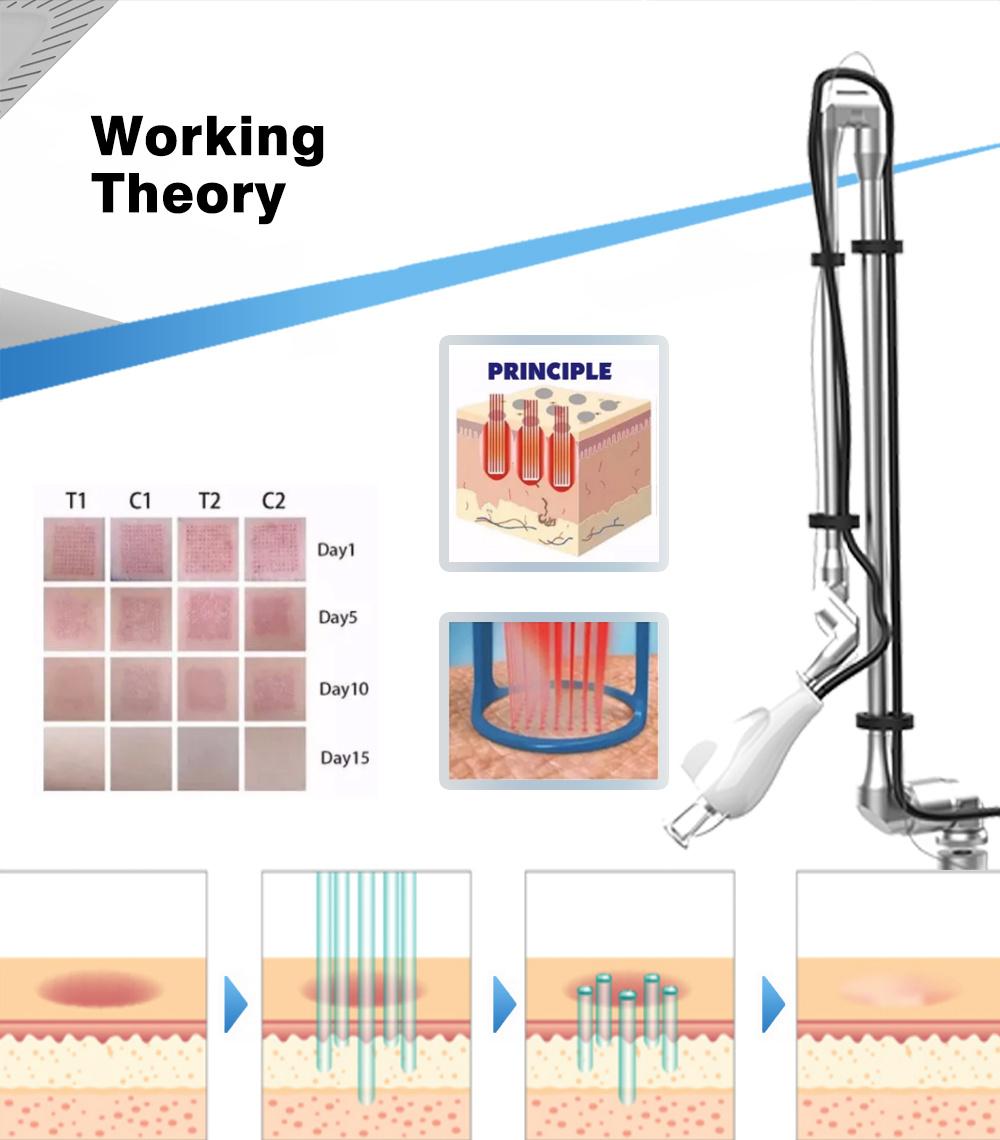 CO2 Laser Cutting Fractional Laser Korea Vagina Tightening Machine