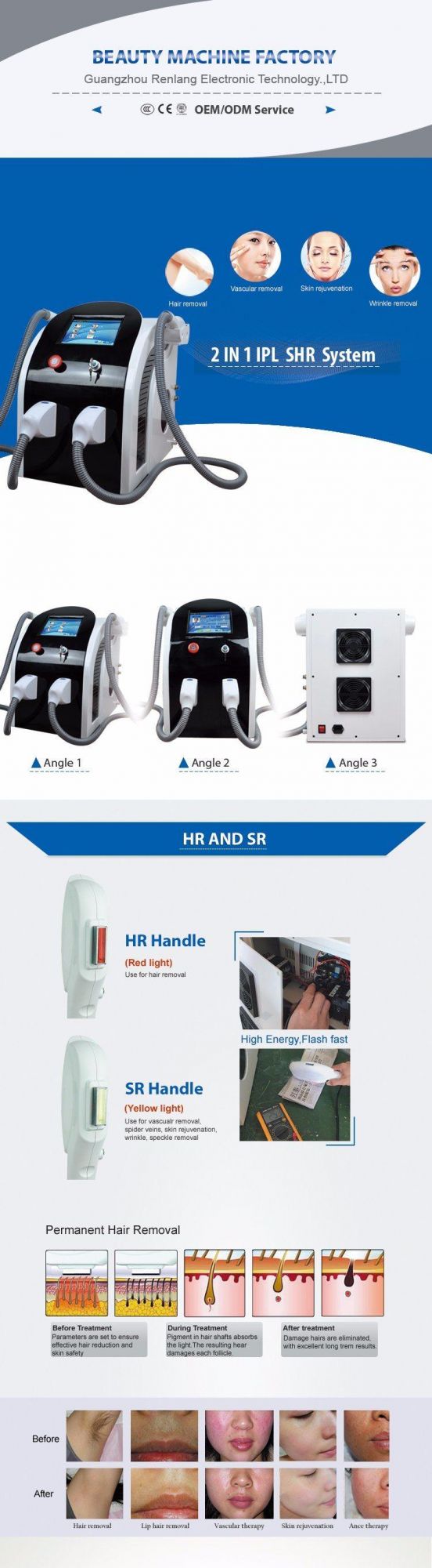 Laser IPL Full Body Laser Hair Removal Machine