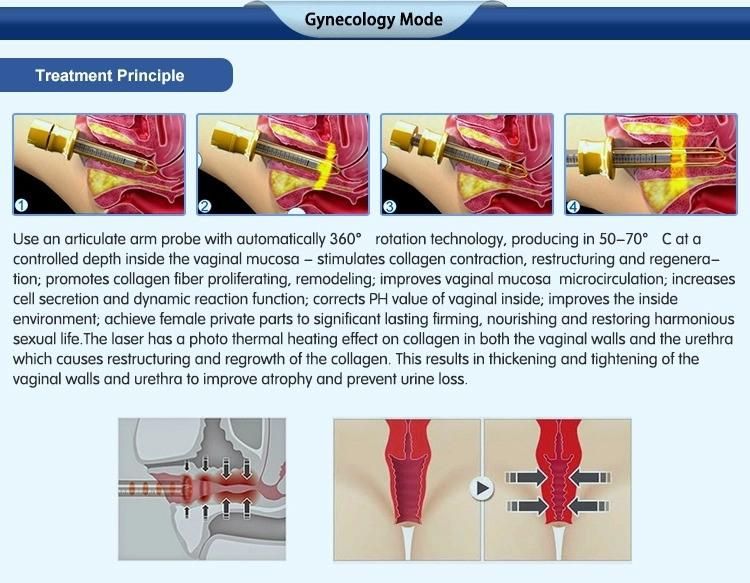 Laser Medical Equipment Scar Removal Machine Laser