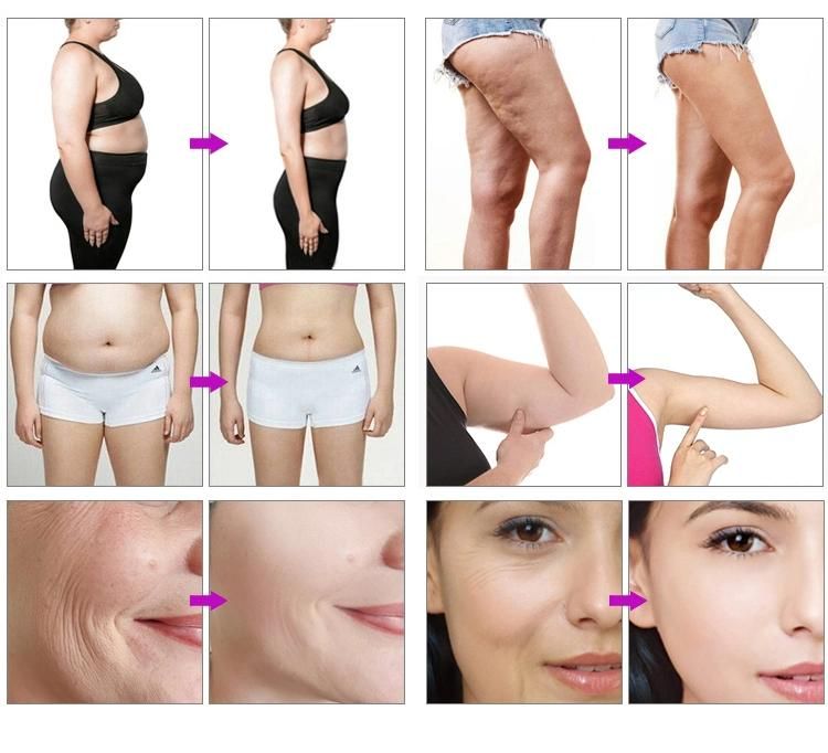 New Design Customized 6 in 1 Vacuum RF 40K Cavitation Lipo Laser Multifunctional Body Slimming Skin Tightening Machine