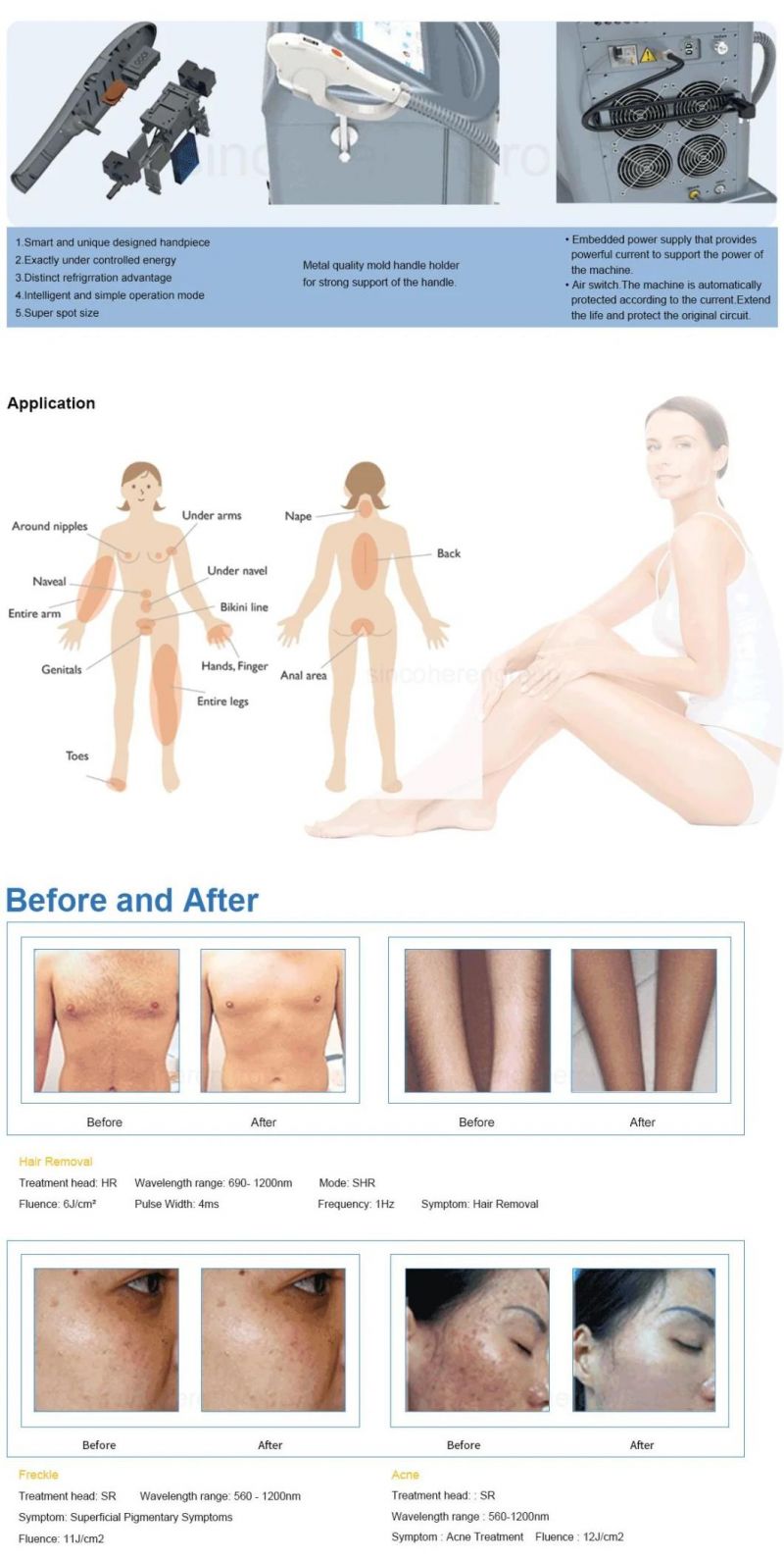 Sincoheren Permanent Laser IPL Hair Removal Permanent Hair Removal