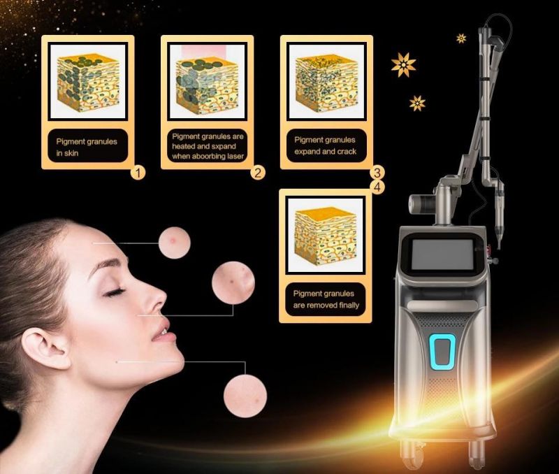 Beauty Product Picosecond Picolaser Acne Tattoo Removal Laser