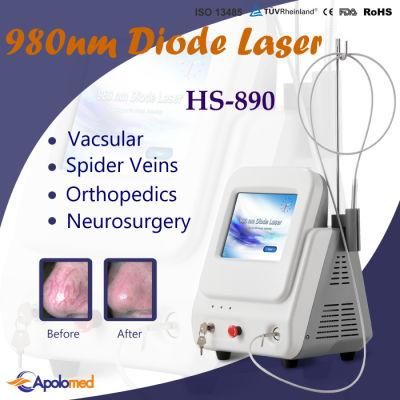 Professional 980 Nm Diode Laser Vascular Removal with Good Treatment Result