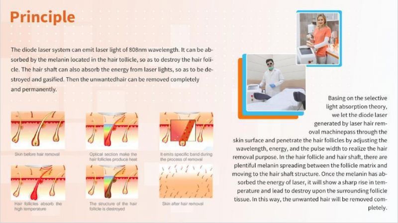 Consultant Dr. Sincoheren Diode Laser Hair Removal Sdl-B 808nm FDA Approved