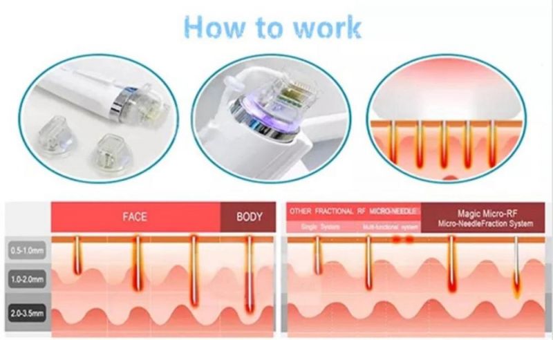 Skin Care, Wrinkles Removal RF Microneedles