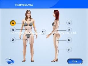 Sculpsure Laser 1064 Nm Cellulite Removal with Good Result