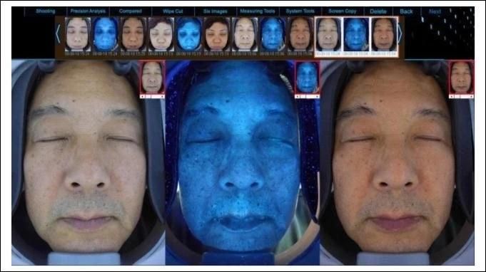 3D Smart Facial Skin Diagnostic Analysis Magic Mirror Skin Tester Analyzer Beauty Equipmentdiagnostic Analysis Magic Mirror