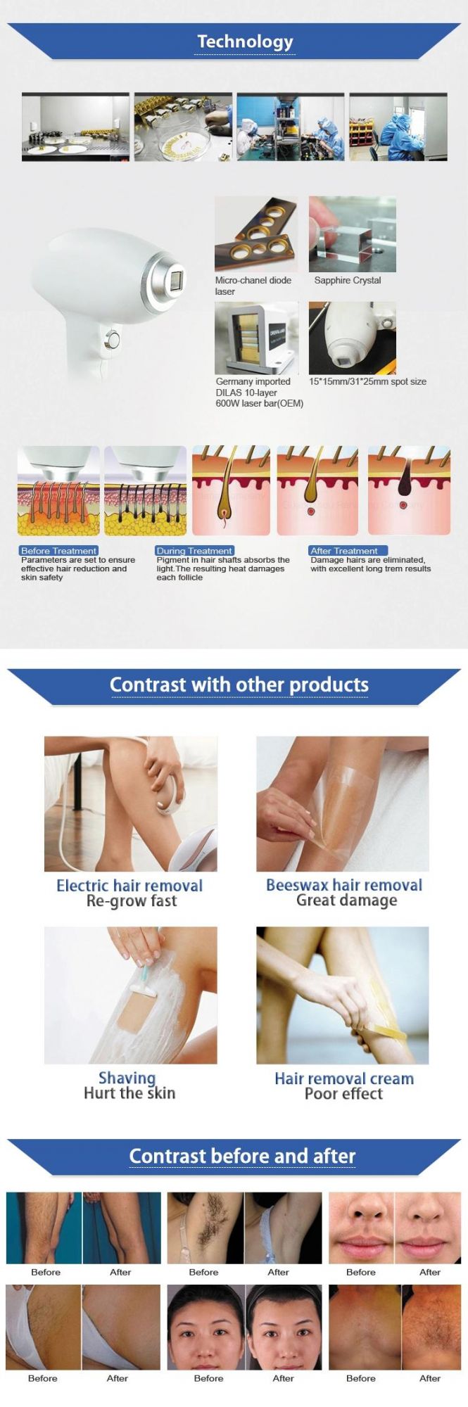 Non Channel 808nm Laser Diode Hair Removal Machine with Ce